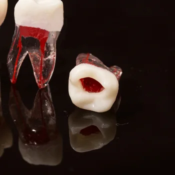1Pc зубоврачебная модел на коренови канали за RCT Practice Pulp Cavity Clear Resin dentis equipment