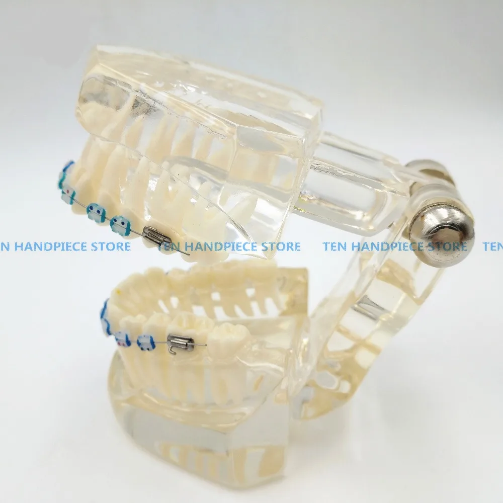 2018 добро качество на стоматологичен ортодонтия Typodont паста за модел наполовина метално, наполовина керамични скоба скоба Typodont с дъга тел
