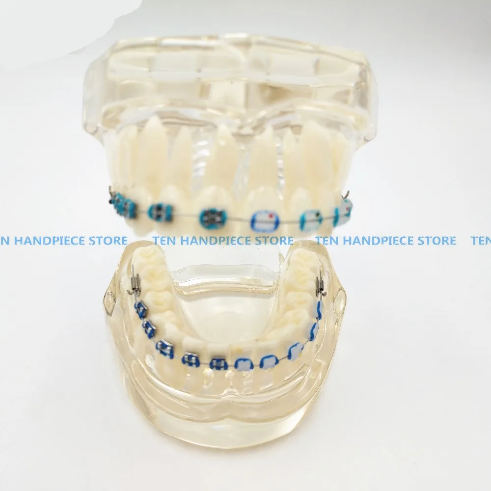 2018 добро качество на стоматологичен ортодонтия Typodont паста за модел наполовина метално, наполовина керамични скоба скоба Typodont с дъга тел